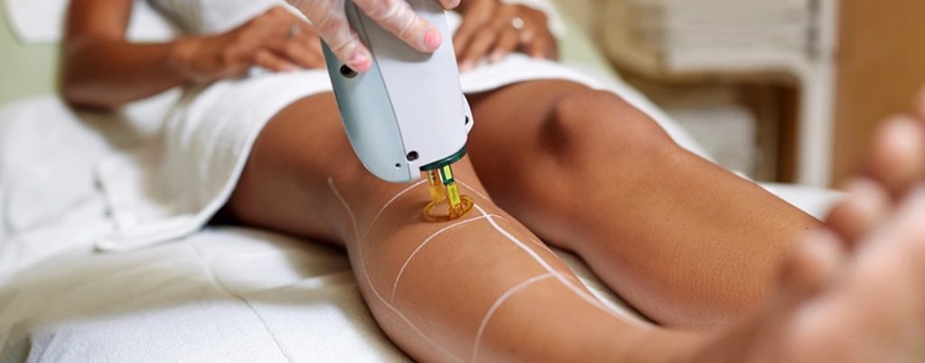 Laser Hair Removal Services